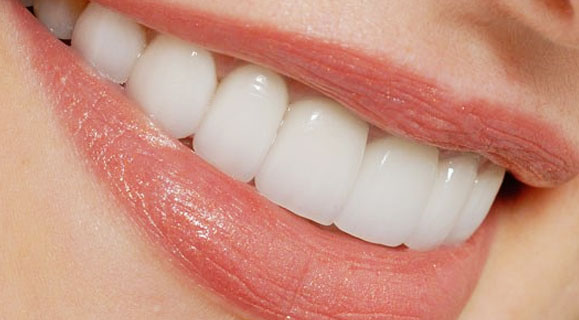 سفید کردن دندان ها به روشی آسان - سفید کردن دندان ها